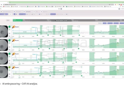 OBR. 1B AI embryoscoring – CATI AI analýza.