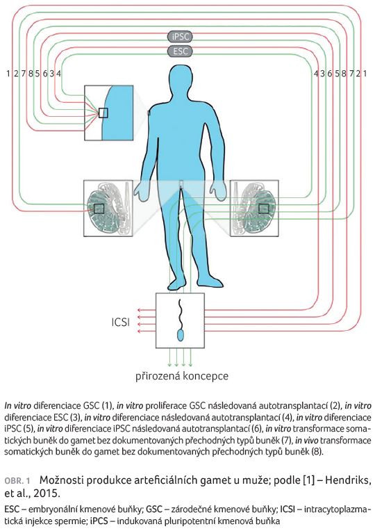 OBR. 1 Možnosti produkce arteficiálních gamet u muže; podle [1] – Hendriks, et al., 2015.