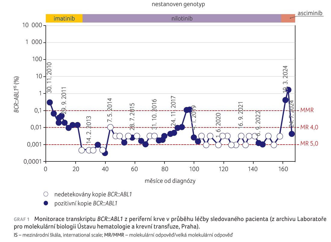 GRAF 1 Monitorace transkriptu BCR::ABL1 z periferní krve v průběhu léčby sledovaného pacienta (z archivu Laboratoře pro molekulární biologii Ústavu hematologie a krevní transfuze, Praha).
