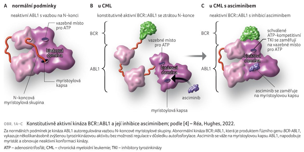OBR. 1A–C Konstitutivně aktivní kináza BCR::ABL1 a její inhibice asciminibem; podle [4] – Réa, Hughes, 2022.
