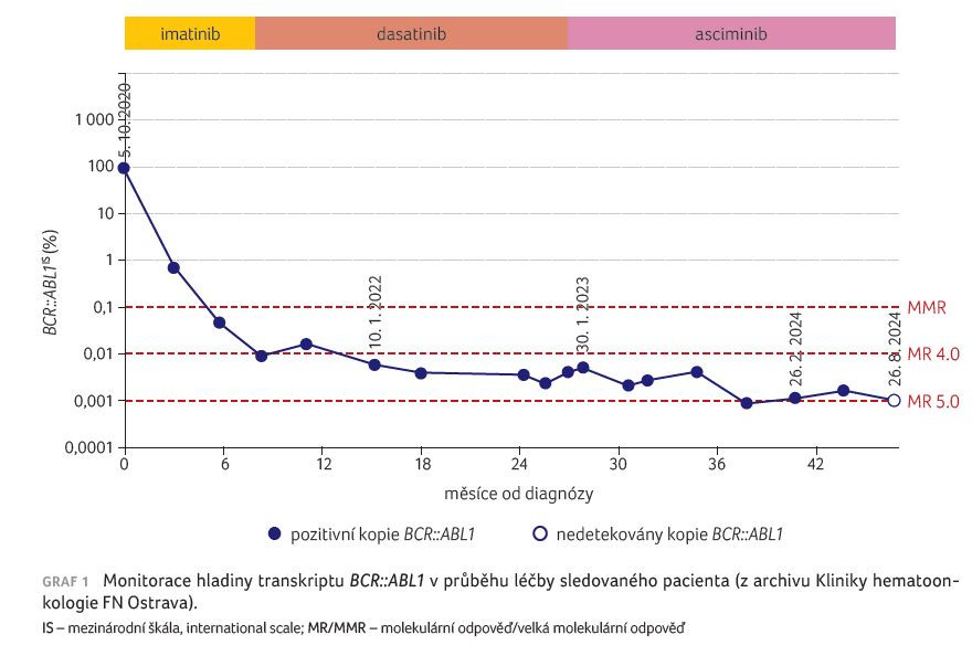 GRAF 1 Monitorace hladiny transkriptu BCR::ABL1 v průběhu léčby sledovaného pacienta (z archivu Kliniky hematoonkologie FN Ostrava).